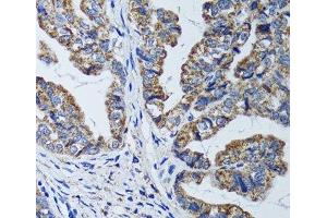 Immunohistochemistry (Paraffin-embedded Sections) (IHC (p)) image for anti-ATP Synthase, H+ Transporting, Mitochondrial F1 Complex, beta Polypeptide (ATP5B) antibody (ABIN7010818)