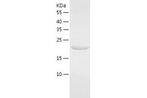 Western Blotting (WB) image for Retinoblastoma Binding Protein 9 (RBBP9) (AA 1-186) protein (His tag) (ABIN7124843) (RBBP9 Protein (AA 1-186) (His tag))