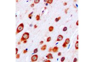 Immunohistochemistry (IHC) image for anti-Corticotropin Releasing Hormone Receptor 2 (CRHR2) (Center) antibody (ABIN7295364)
