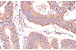 Immunohistochemistry (Paraffin-embedded Sections) (IHC (p)) image for anti-Potassium Voltage-Gated Channel, Subfamily H (Eag-Related), Member 2 (KCNH2) antibody (ABIN7260745)