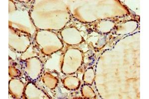 Immunohistochemistry of paraffin-embedded human thyroid tissue using ABIN7169127 at dilution of 1:100 (PAK2 抗体  (AA 1-212))