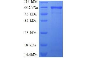 Aldolase A, Fructose-Bisphosphate (ALDOA) (AA 2-364), (full length) protein (GST tag) (ALDOA Protein (AA 2-364, full length) (GST tag))