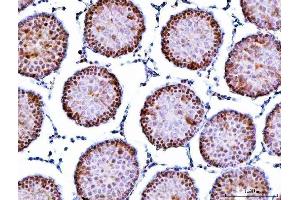 IHC analysis of Symplekin/SYMPK using anti-Symplekin/SYMPK antibody (ABIN7601558).