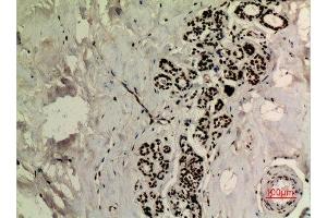 Immunohistochemistry (IHC) image for anti-Tumor Protein P53 (TP53) (acLys370) antibody (ABIN3181892)