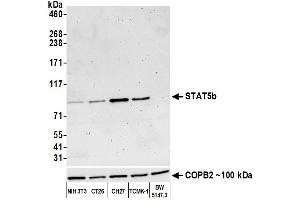 anti-Signal Transducer and Activator of Transcription 5B (STAT5B) (AA 737-787) antibody