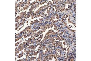 IHC analysis of SCO1 using anti-SCO1 antibody (ABIN7600609).