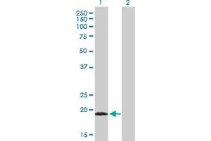 Western Blot analysis of TPPP3 expression in transfected 293T cell line by TPPP3 MaxPab polyclonal antibody. (TPPP3 抗体  (AA 1-176))