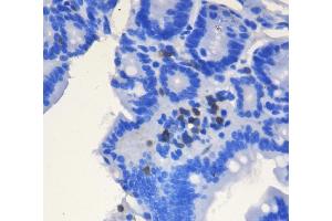 IHC analysis of CD3 epsilon/Cd3e using anti-CD3 epsilon/Cd3e antibody (ABIN7600665).
