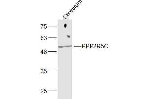 PPP2R5C 抗体  (AA 390-435)