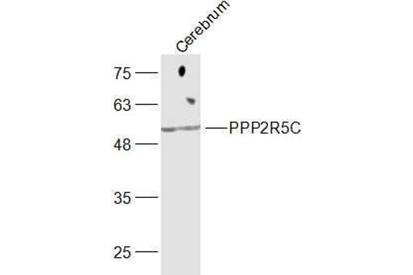 PPP2R5C 抗体  (AA 390-435)