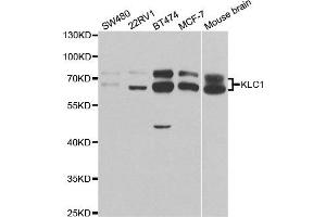 Western Blotting (WB) image for anti-Kinesin Light Chain 1 (KLC1) antibody (ABIN1876732) (KLC1 抗体)