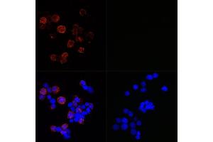Immunofluorescence analysis of 293T-N and 293T cells using SARS-CoV-2 Nucleoprotein Rabbit mAb (ABIN7269052) at dilution of 1:100,1:400,1:1600,1:3200 (40x lens). (SARS-CoV-2 Spike S2 抗体)