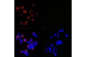 Immunofluorescence analysis of 293T-N and 293T cells using SARS-CoV-2 Nucleoprotein Rabbit mAb (ABIN7269052) at dilution of 1:100,1:400,1:1600,1:3200 (40x lens). (Nucleoprotein 抗体)