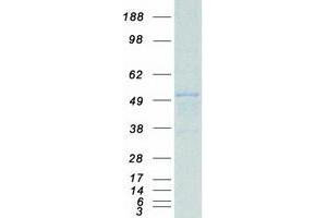 Western Blotting (WB) image for SWI/SNF Related, Matrix Associated, Actin Dependent Regulator of Chromatin, Subfamily E, Member 1 (SMARCE1) protein (Myc-DYKDDDDK Tag) (ABIN2732241)