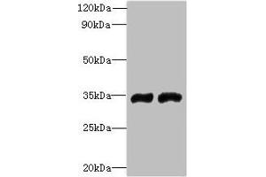 Western blot All lanes: FYTTD1 antibody at 4 μg/mL Lane 1: A375 whole cell lysate Lane 2: Jurkat whole cell lysate Secondary Goat polyclonal to rabbit IgG at 1/10000 dilution Predicted band size: 36, 34, 29, 15 kDa Observed band size: 36 kDa
