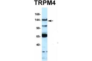 Western Blotting (WB) image for anti-Transient Receptor Potential Cation Channel, Subfamily M, Member 4 (TRPM4) (N-Term) antibody (ABIN2776221)