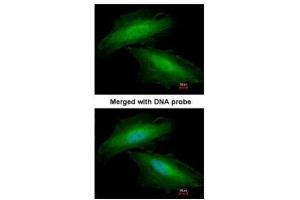 ICC/IF Image Immunofluorescence analysis of paraformaldehyde-fixed HeLa, using Annexin I, antibody at 1:200 dilution. (Annexin a1 抗体)