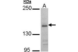 Western Blotting (WB) image for anti-Glutamate Receptor, Ionotropic, N-Methyl D-Aspartate 2B (GRIN2B) (AA 1010-1259) antibody (ABIN467519) (GRIN2B 抗体  (AA 1010-1259))