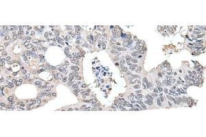 Immunohistochemistry (Paraffin-embedded Sections) (IHC (p)) image for anti-Transcription Elongation Factor B (SIII), Polypeptide 2 (18kDa, Elongin B) (TCEB2) antibody (ABIN7245644)