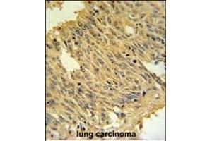 Immunohistochemistry (Paraffin-embedded Sections) (IHC (p)) image for anti-Solute Carrier Family 25, Member 28 (SLC25A28) (AA 36-64), (N-Term) antibody (ABIN651437)