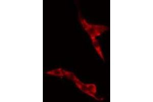 ABIN6275488 staining A549 cells by IF/ICC. (ARHGDIG 抗体  (Internal Region))