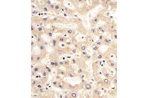 (ABIN659060 and ABIN2838063) staining PDK2 in human liver sections by Immunohistochemistry (IHC-P - paraformaldehyde-fixed, paraffin-embedded sections). (PDK2 抗体)