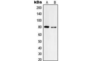 Western blot analysis of Tyrosinase expression in A375 (A), HepG2 (B) whole cell lysates.