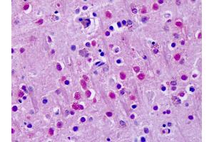 Anti-ROR Alpha / RORA antibody IHC of human brain, cortex. (RORA 抗体  (Hinge Region))