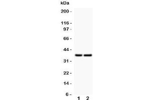 Western blot testing of CD79a antibody and Lane 1:  human placenta;  2: rat spleen; Predicted/Observed molecular weight: 25~47 kDa depending on glycosylation level (CD79a 抗体  (AA 121-226))