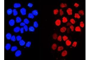 IF analysis of Histone H1.