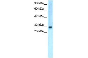 Western Blot showing EAP30 antibody used at a concentration of 5. (SNF8 抗体  (N-Term))