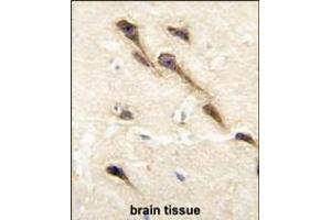 Immunohistochemistry (Paraffin-embedded Sections) (IHC (p)) image for anti-Cytochrome P450, Family 26, Subfamily B, Polypeptide 1 (CYP26B1) (AA 398-430), (C-Term) antibody (ABIN392528)