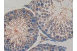 Detection of LBP in Mouse Testis Tissue using Polyclonal Antibody to Lipopolysaccharide Binding Protein (LBP) (LBP 抗体  (AA 25-481))
