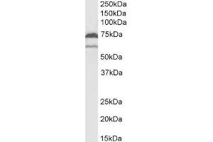 Western Blotting (WB) image for anti-Prostaglandin-Endoperoxide Synthase 1 (Prostaglandin G/H Synthase and Cyclooxygenase) (PTGS1) (C-Term) antibody (ABIN184671)