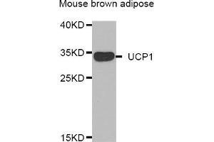 Western blot analysis of extracts of mouse brown adipose, using UCP1 antibody (ABIN5974361). (UCP1 抗体)