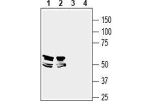 Western blot analysis of mouse brain (lanes 1 and 3) and rat hippocampus (lanes 2 and 4) lysates: - 1,2. (LRRTM1 抗体  (Extracellular, N-Term))