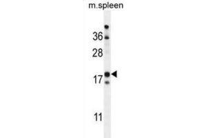 Western Blotting (WB) image for anti-Retinol Binding Protein 7, Cellular (RBP7) antibody (ABIN2999706) (RBP7 抗体)