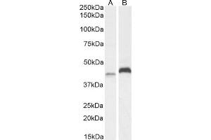 (ABIN184935) (2 μg/mL) staining of A431 (A) and HeLa (B) cell lysate (35 μg protein in RIPA buffer). (RNF13 抗体  (C-Term))