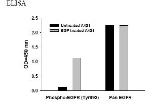 Image no. 3 for Epidermal Growth Factor Receptor (EGFR) ELISA Kit (ABIN625225)