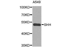 Western blot analysis of extracts of A-549 cells, using SHH antibody. (Sonic Hedgehog 抗体)