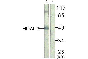 Immunohistochemistry analysis of paraffin-embedded human skin tissue, using HDAC3 (Ab-424) antibody. (HDAC3 抗体)