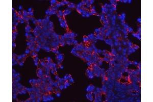 IF analysis of SFTPA1/2 using anti-SFTPA1/2 antibody (ABIN3043922).