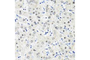Immunohistochemistry of paraffin-embedded Human liver using TRIM27 antibody (ABIN7269922) at dilution of 1:100 (40x lens). (TRIM27 抗体  (AA 1-200))