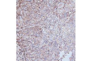 IHC analysis of DDR1 using anti-DDR1 antibody (ABIN7601407). (DDR1 抗体  (AA 341-909))