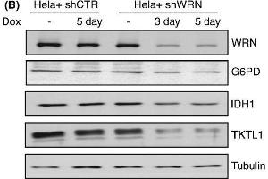 Werner syndrome protein (WRN) depletion alters the levels of metabolic enzymes. (Glucose-6-Phosphate Dehydrogenase 抗体)