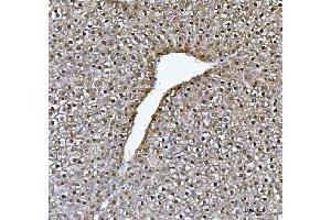 IHC analysis of FAA/FAH using anti-FAA/FAH antibody (ABIN7599291).