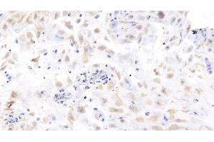 Detection of LHb in Human Placenta Tissue using Monoclonal Antibody to Luteinizing Hormone Beta Polypeptide (LHb) (LHB 抗体  (AA 21-141))