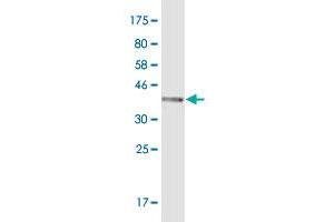 Western Blot detection against Immunogen (37. (AKR1C1 抗体  (AA 1-110))