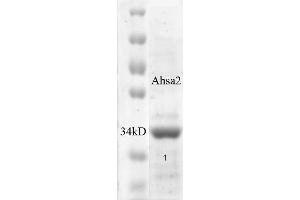 SDS-PAGE of ~38 kDa his-tagged human Aha2 protein (ABIN1686735, ABIN1686736 and ABIN1686737). (HA2 Protein (His tag))