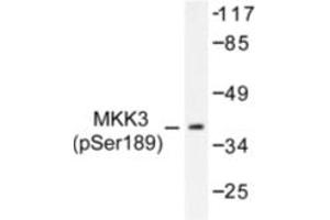 Image no. 1 for anti-Mitogen-Activated Protein Kinase Kinase 3 (MAP2K3) (pSer189) antibody (ABIN318070)